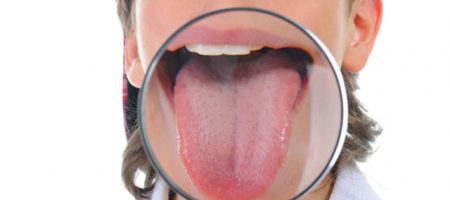 ¿POR QUÉ CEPILLARSE LA LENGUA?